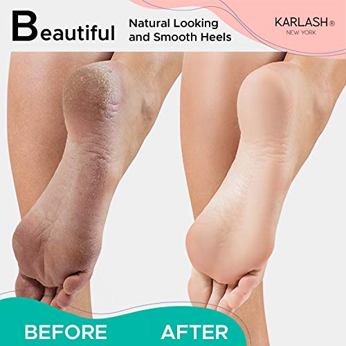 Karlash Професионална Педикюрная пемза за премахване на мазоли на краката и Скрубер за отстраняване на мъртвата