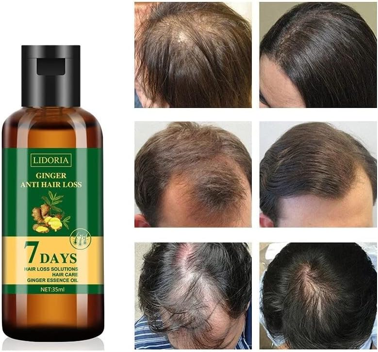 Защита от Загуба на коса с Етерично масло за Растежа на косата, бързо производител, Предотвращающее Оплешивяване, Грижа
