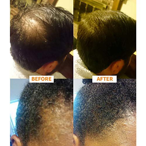 Nor1 Keratin Hair Building Fibers: Пълнители и загуститель за коса за мъже и жени - Коректор средство за поредевших парцели